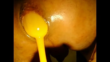 100 2887.MOV rica dilatacion de mi ano