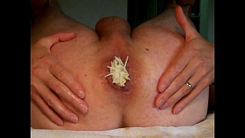 Anal Fist Toy Insertion Gape Ass Play -analdehner Ass Hole Extrem Gay Men