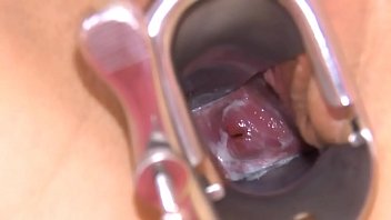 Gyno Dildo And Pussy Gapped Very Hard - toy, masturbation, fetish, erotica, movies - Video 5575643