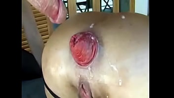 Porn - Bizarre Milf Moms Hardcore Anal Fisting Prolapse