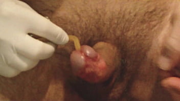 Foley Catheter Ch 20 - Insertion And Play