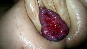 2nd Self-fisting Ass-cunt