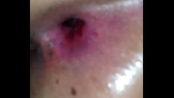 Meti Rola No Cu Da Cachorra E Mostrei O Estrago