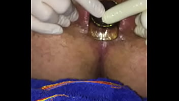 6cm Plug Play With Small First Time Prolapse