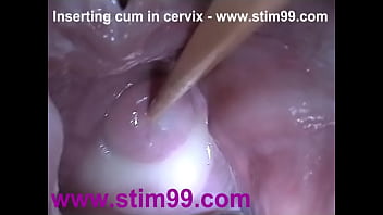 Insertion Semen Cum In Cervix Wide Stretching Pussy Speculum