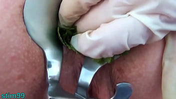 Nettles Ass Fisting Anal Insertion Nettles With Speculum