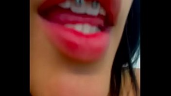 Home D20 Another Beautiful Braces Girl