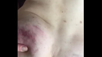 Ass, Short, Bruises - Ass - 2025 - Steamy - Session - Video 4349056