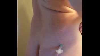 Buttocks, Injections - Unknown - 2025 - Passionate - Session - Video 4178553