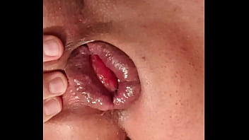 Ass, Fisting, Gay, Prolapse, Pidor - Gay - 2025 - Intense - Performance - Video 4004069