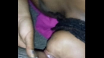 Ebony Made Me Feel Great After The Surgery