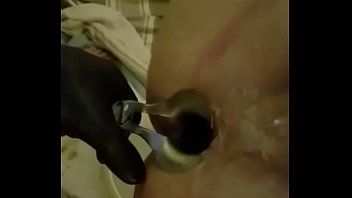 Gay, Speculum, Piss, Enema - Gay - 2025 - Wild - Session - Video 4112289