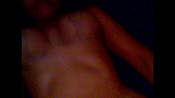 Colombiana Recien Operada De Las Tetas