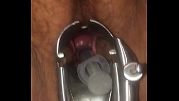 Artificial Insemination Putting Cum In Cervix