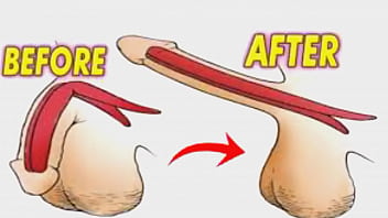 Penis Enlargement - grow-penis-size, improve-sex-timing - Video 3823394
