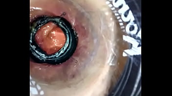 Analalain His Asshole