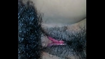 Le Dejó La Concha Hinchada