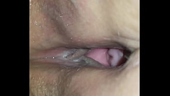 P. Anal Try