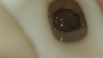 Cách Lấy Tinh Trùng