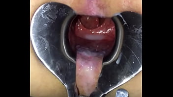 Playing With Speculum 3