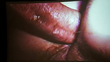 Hairy Butthole Spread Open