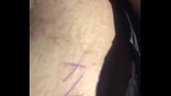 Beule In Knappen Shorts