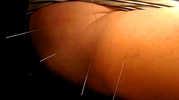 Acupuncture 2 With Playerdoi