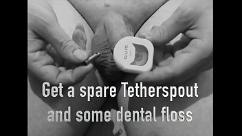 Removal Of The Tetherspout