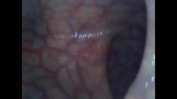 Lucy Takes An Endoscope Up Her Ass