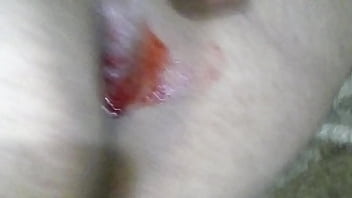 Gay Arrombando O Cuzinho Com O Vibrador