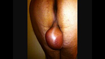 Anal _ Glucose 10% 250 ml infusion ball 27.6.2013