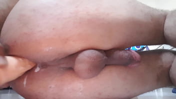 Terminacion Anal De Leches