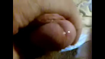 My Pricks Prostate Sperm Underneath And The Cutted Prickshead.