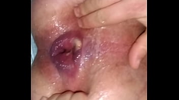 Metendo O Tubo De Creme No Cuzinho