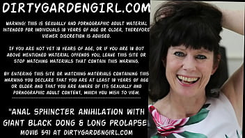 Anal Sphincter Anihilation With Giant Black Dong _ Long Prolapse