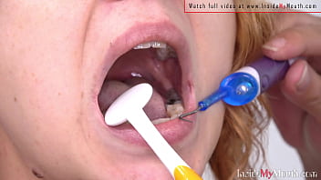 Mouth Fetish Video - Alex Get Dental And Mouth Examination From Sarah