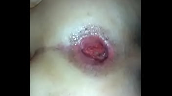 Levando Plug Grosso No Cu