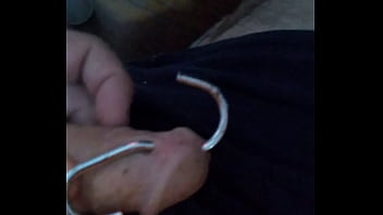 Kitchen Handle Through Urethra