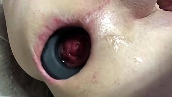 Trying Out My New Anal Expansion Ring Part 1