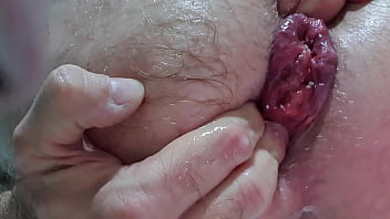 Prolapse Novinho Iniciante