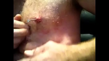 Nails Removd From Nipples