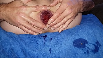 Anal, Handjob, Fingering, Wet, Fetish, Gay, Massage, Fun, Prolapse, Rosebud, Gay-anal - Gay - 2025 - Intense - Session - Video 2490284