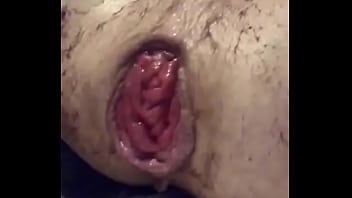 Gay, Prolapse, Rosebud - Gay - 2025 - Amazing - Performance - Video 2472013