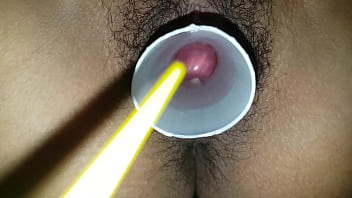Colombian Amateur Cervix Play Part 2