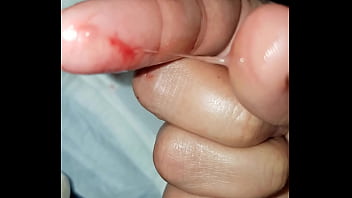 Colombian Amateur Cervix Play Part 9