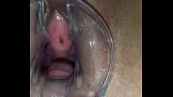 Con La Concha Bien Abierta Con El Especulo Que Me Mete Juan