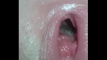 Ampliacion De Mi Chela