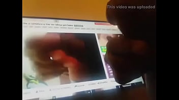 Antes E Depois Da Frenuplastia