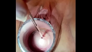 Muscle Spasms Cervix Electrosound