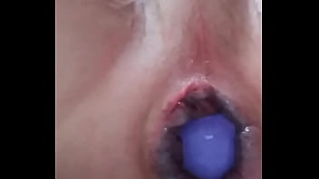 Soloboy, Prolapsed, Anal-stretch, Anal-trainer - Unknown - 2025 - Hot - Experience - Video 2159560